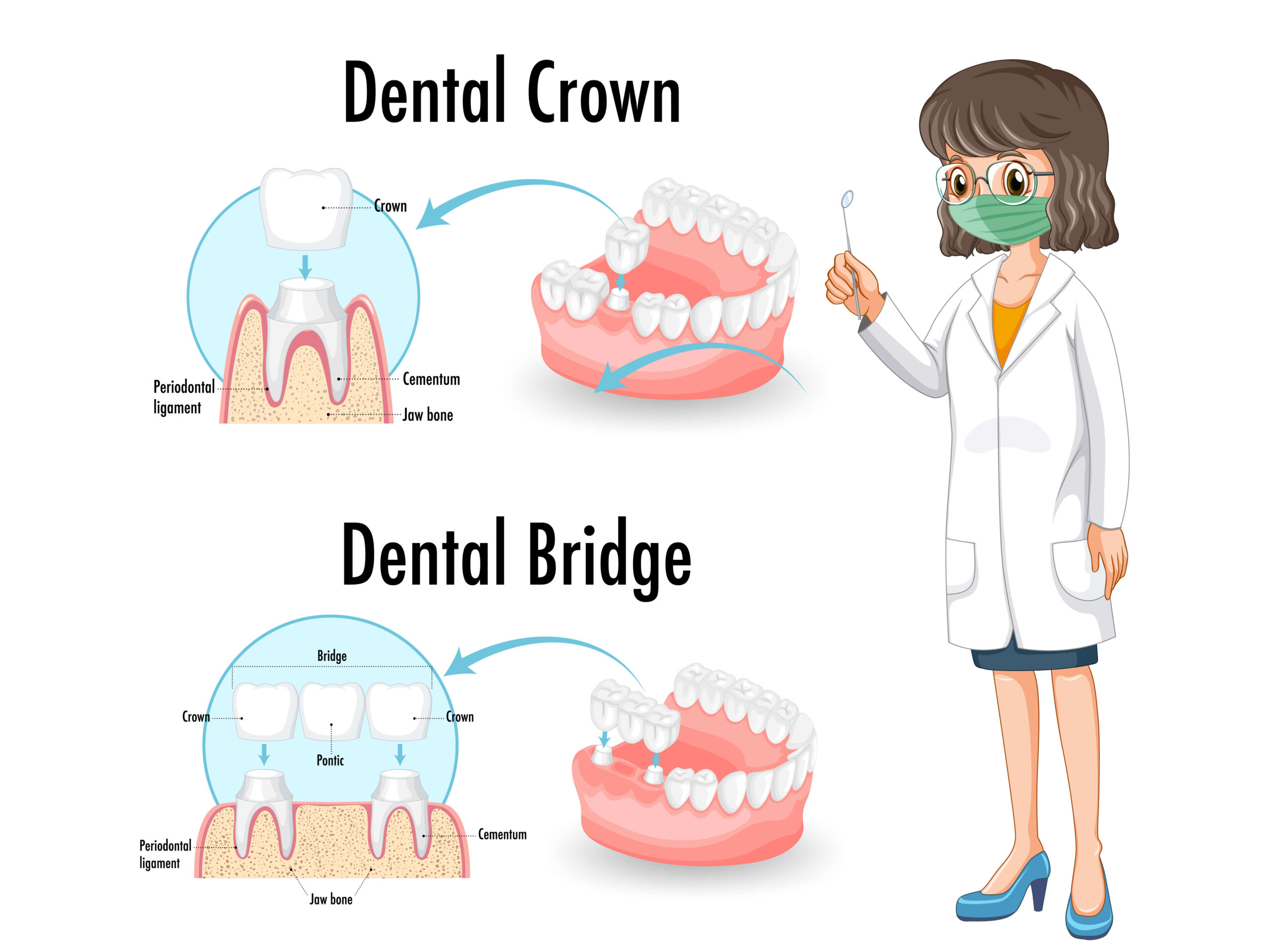 Teeth Problems That Crowns And Bridges Can Correct