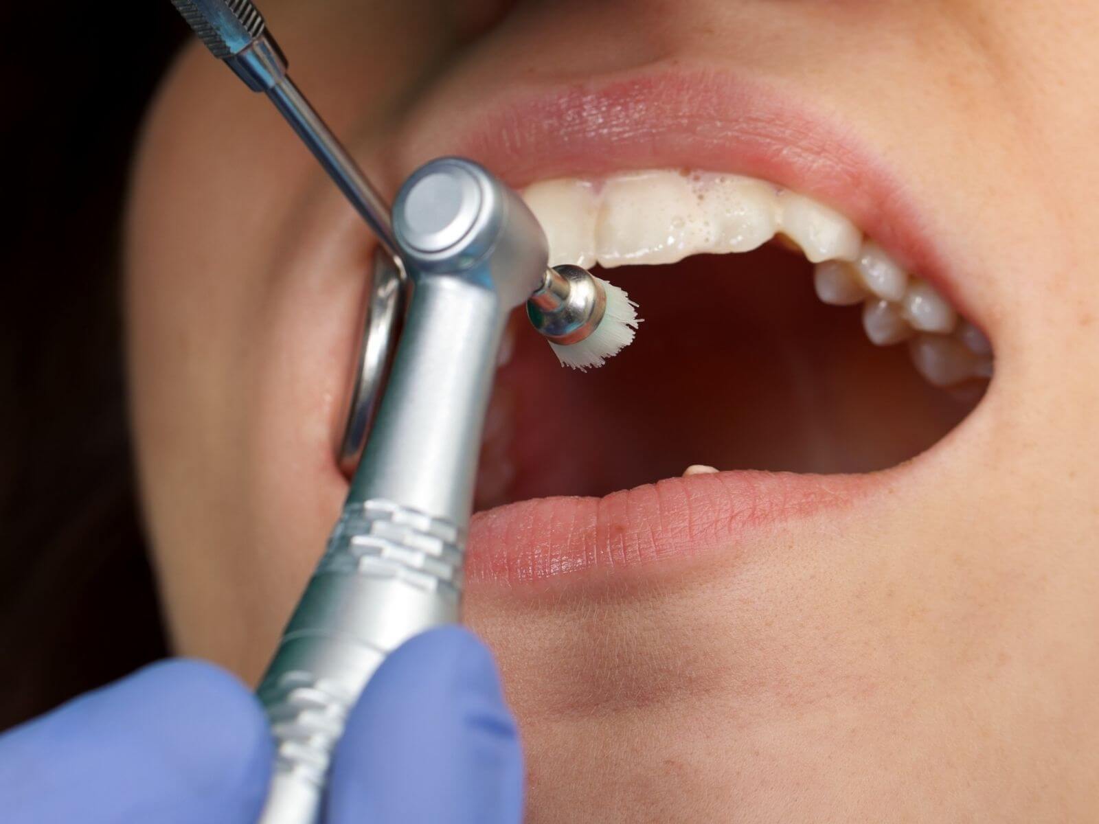 The Difference Between Urgent Vs. Non-Urgent Dental Care