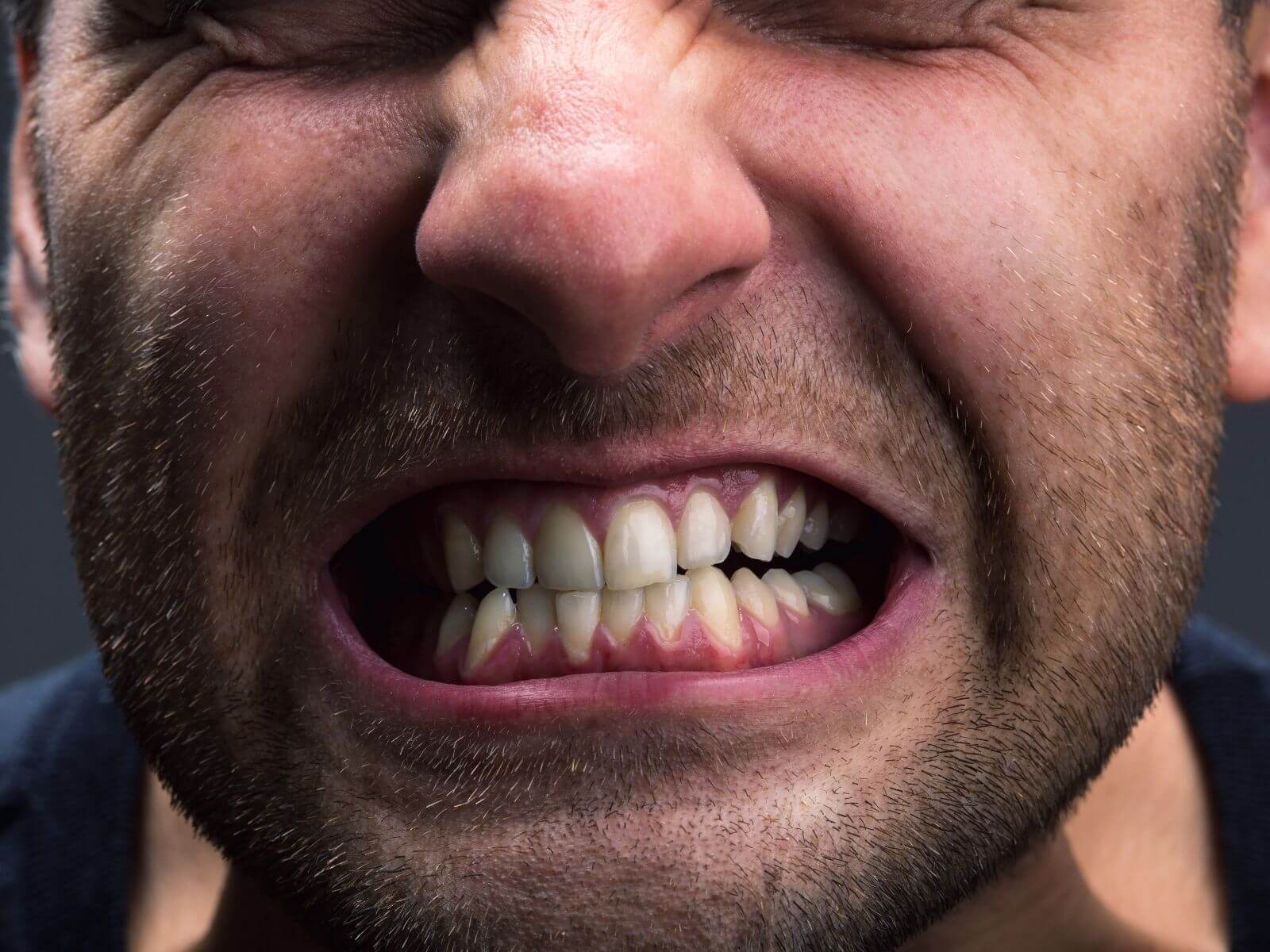 Understanding The Importance of Night Guards For Teeth Grinding